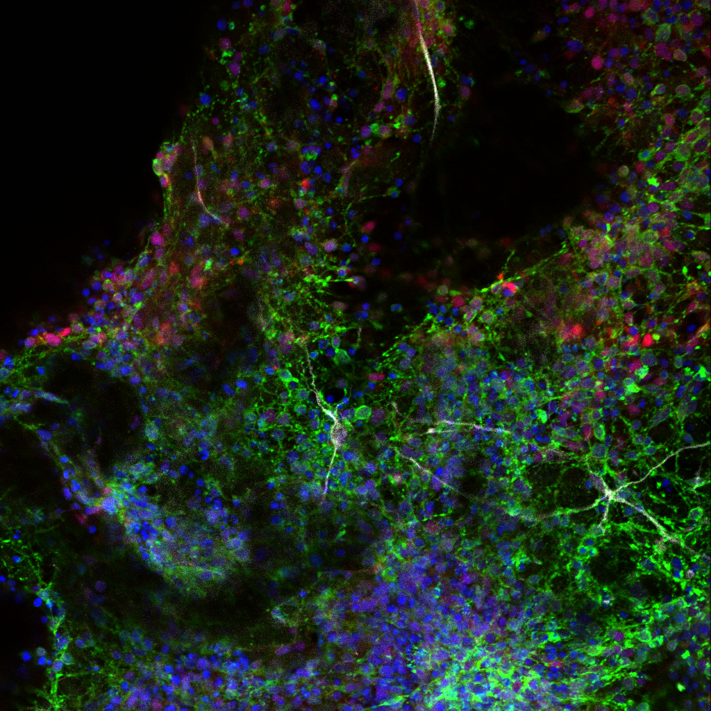 Neurons on a hydrogel scaffold